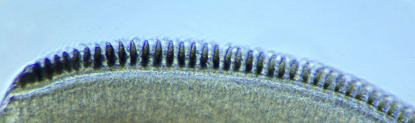 Die Zahnreihe eines Egels